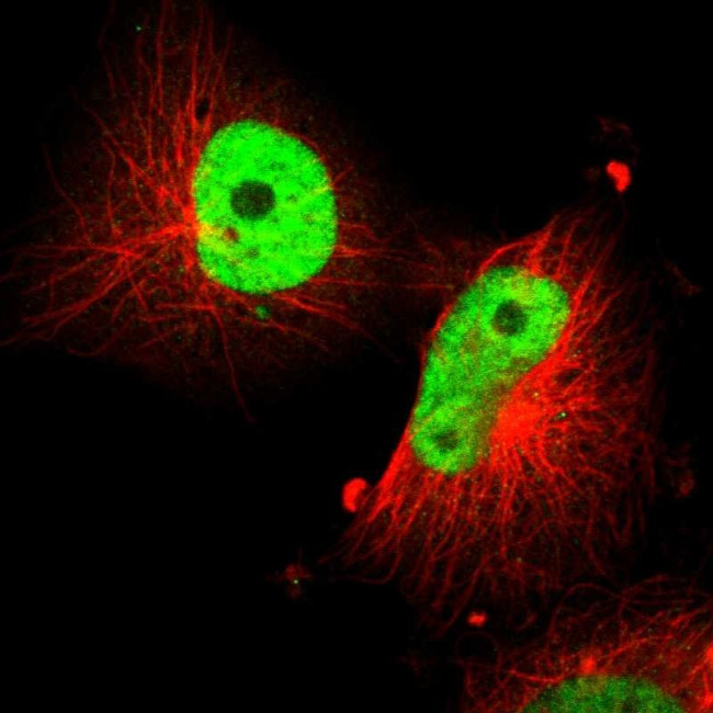 SOX9 Antibody in Immunocytochemistry (ICC/IF)