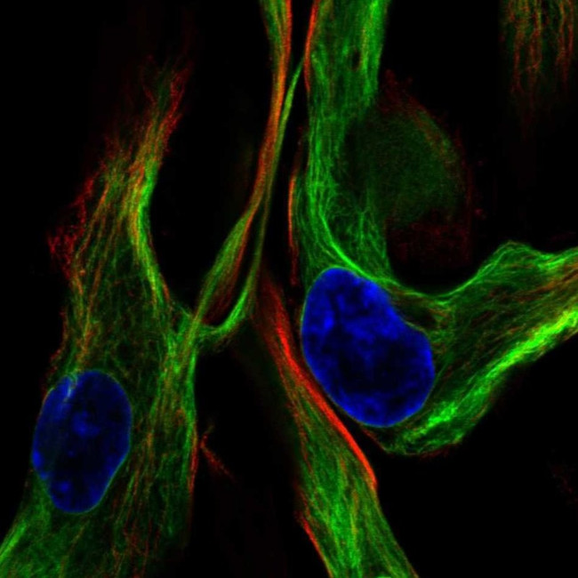 Vimentin Antibody in Immunocytochemistry (ICC/IF)