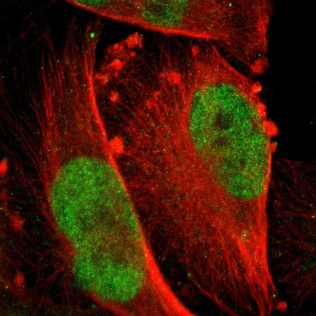 MSK1 Antibody in Immunocytochemistry (ICC/IF)