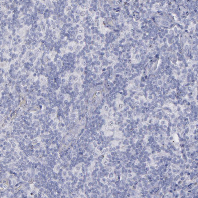 SNAP25 Antibody in Immunohistochemistry (Paraffin) (IHC (P))