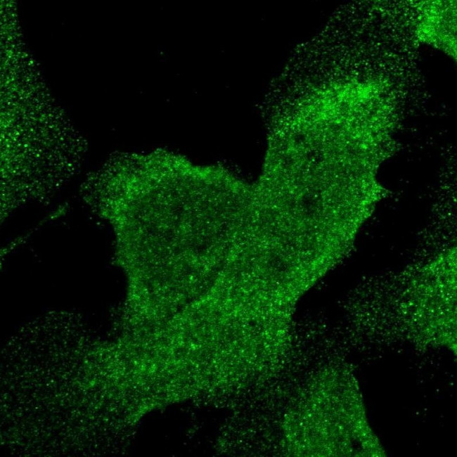 STAT6 Antibody in Immunocytochemistry (ICC/IF)