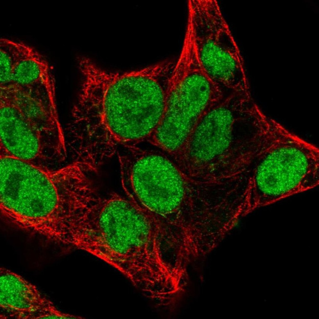 CHK2 Antibody in Immunocytochemistry (ICC/IF)