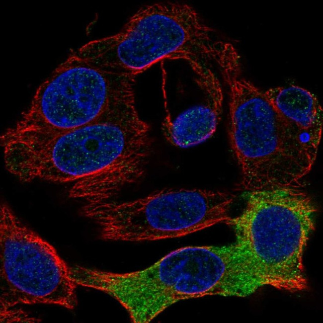 FIBB Antibody in Immunocytochemistry (ICC/IF)