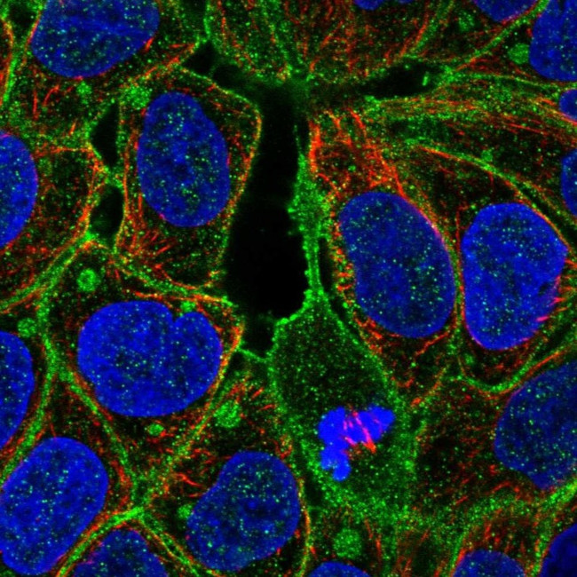 FGR Antibody in Immunocytochemistry (ICC/IF)