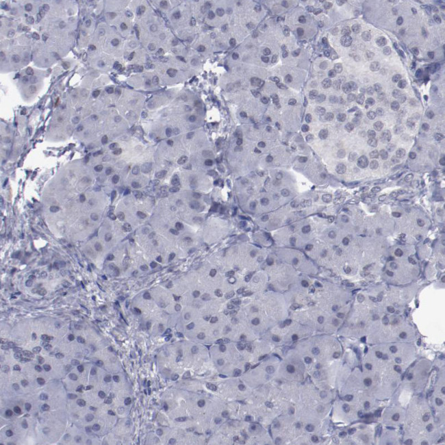 IRF4 Antibody in Immunohistochemistry (Paraffin) (IHC (P))