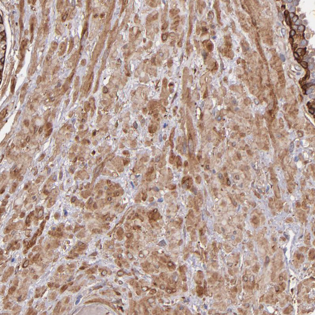 Vinculin Antibody in Immunohistochemistry (Paraffin) (IHC (P))