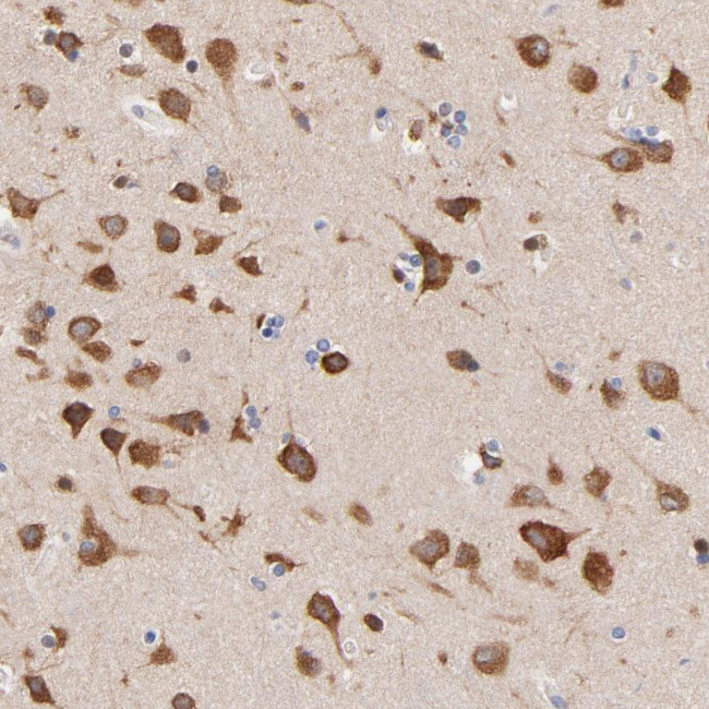 HS3ST1 Antibody in Immunohistochemistry (Paraffin) (IHC (P))