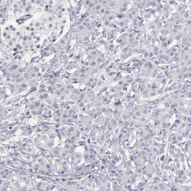 MRP4 Antibody in Immunohistochemistry (Paraffin) (IHC (P))