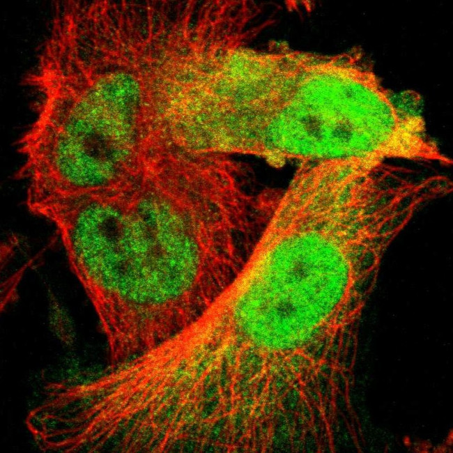 CDK6 Antibody in Immunocytochemistry (ICC/IF)