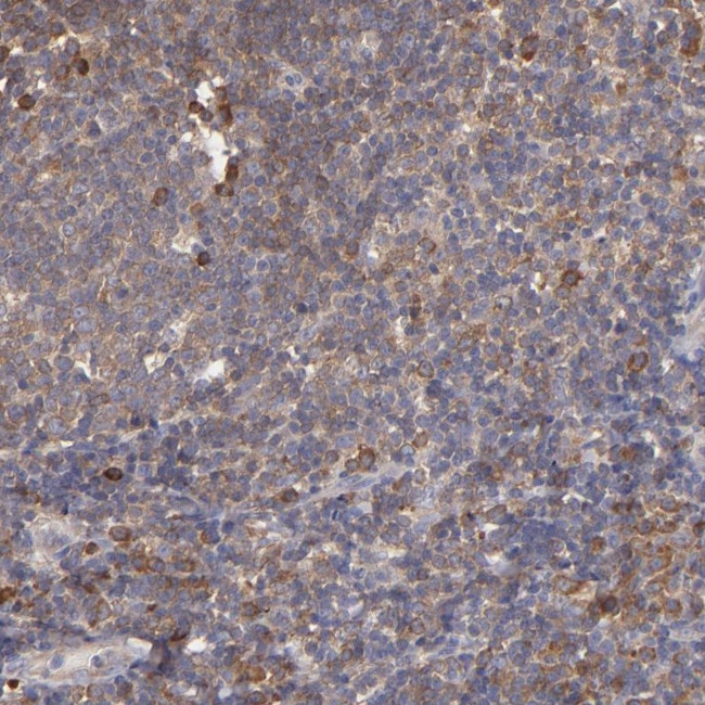 IkB epsilon Antibody in Immunohistochemistry (Paraffin) (IHC (P))