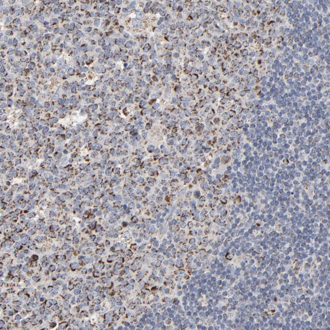 UQCRC1 Antibody in Immunohistochemistry (Paraffin) (IHC (P))