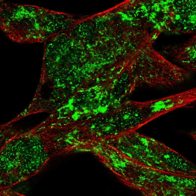 RSK4 Antibody in Immunocytochemistry (ICC/IF)