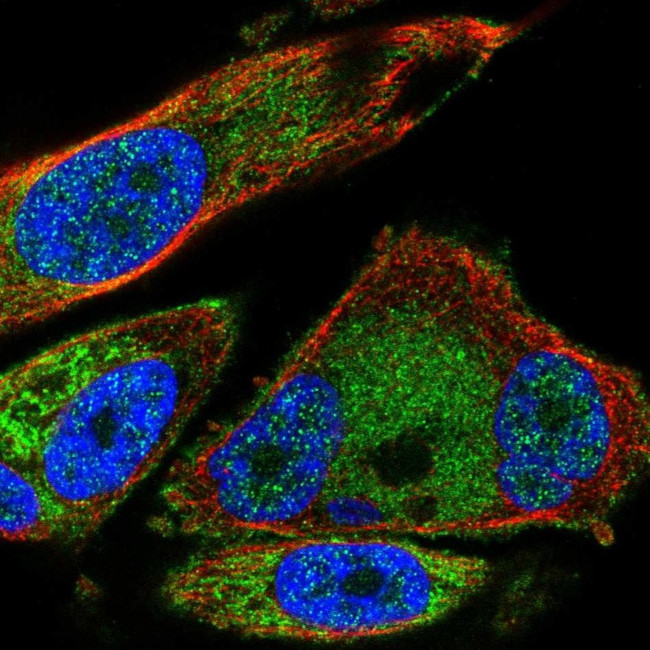 SDHB Antibody in Immunocytochemistry (ICC/IF)