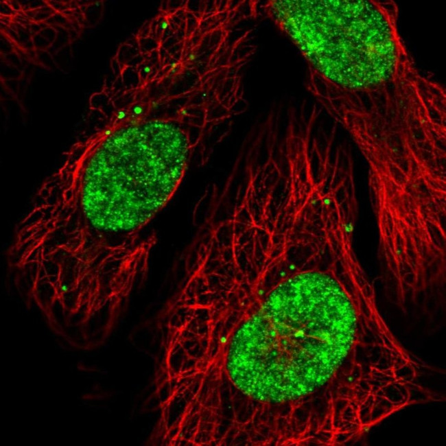 CECR2 Antibody in Immunocytochemistry (ICC/IF)