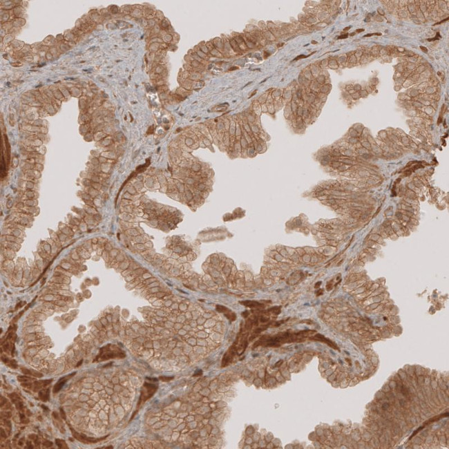 NG2 Antibody in Immunohistochemistry (Paraffin) (IHC (P))