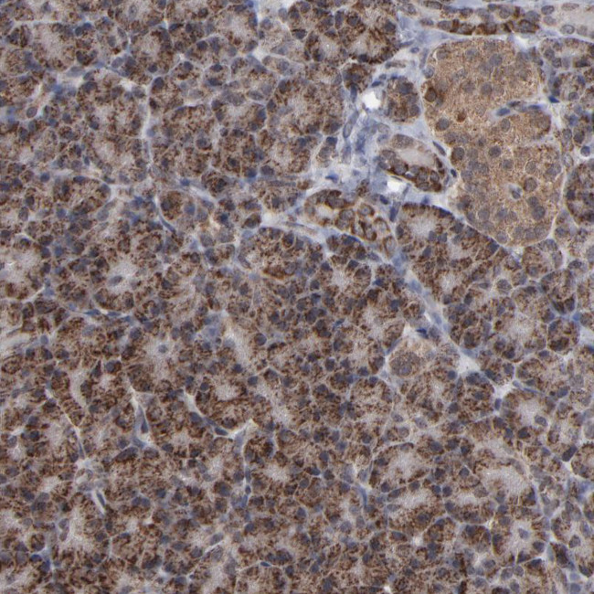 BNIP3 Antibody in Immunohistochemistry (Paraffin) (IHC (P))