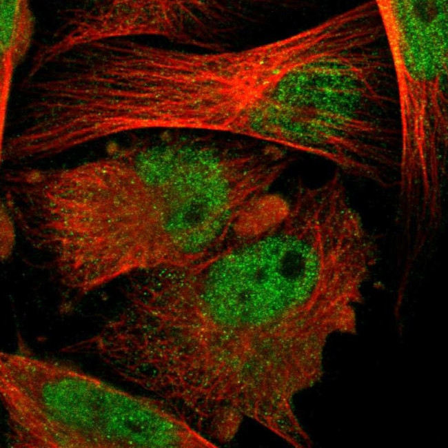 PSMA6 Antibody in Immunocytochemistry (ICC/IF)