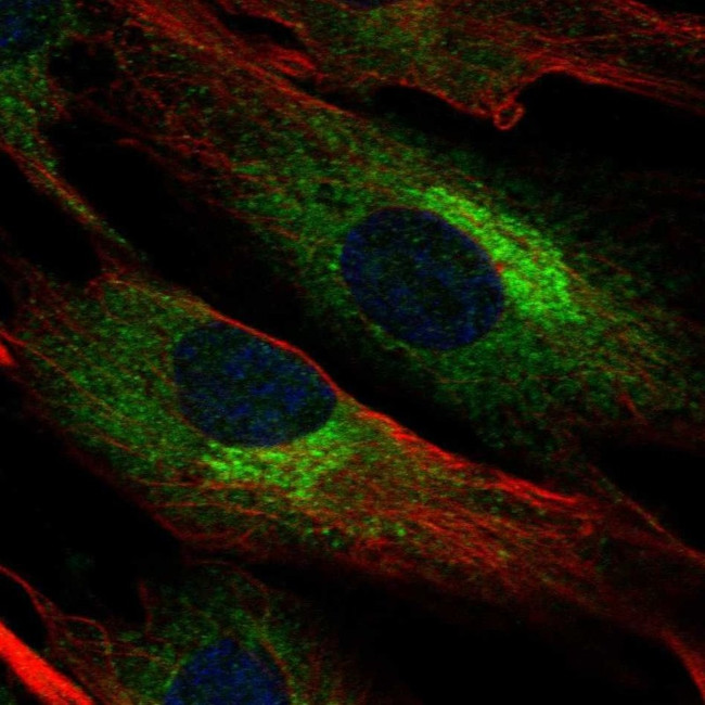 Biglycan Antibody in Immunocytochemistry (ICC/IF)