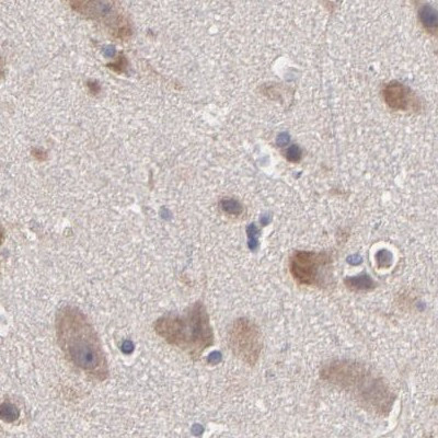 TCP-1 beta Antibody in Immunohistochemistry (Paraffin) (IHC (P))