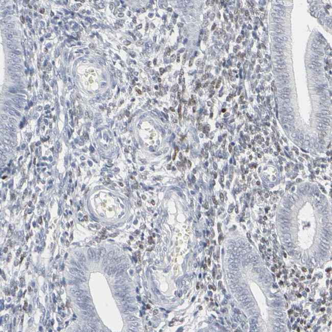 MiTF Antibody in Immunohistochemistry (Paraffin) (IHC (P))