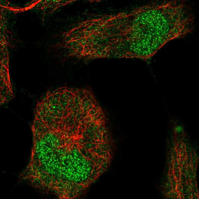 Brachyury Antibody in Immunocytochemistry (ICC/IF)