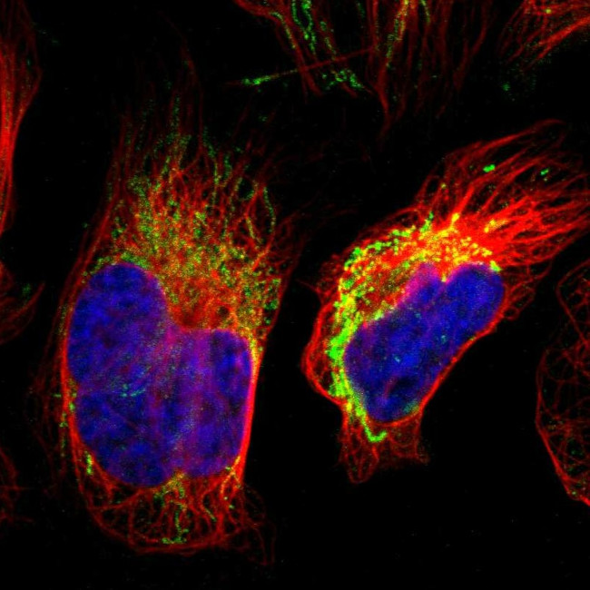 S100A10 Antibody in Immunocytochemistry (ICC/IF)