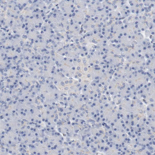 ZEB2 Antibody in Immunohistochemistry (Paraffin) (IHC (P))