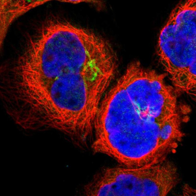 LCK Antibody in Immunocytochemistry (ICC/IF)