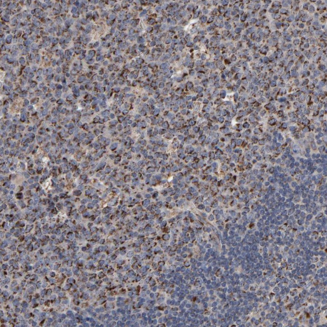 UQCRC1 Antibody in Immunohistochemistry (Paraffin) (IHC (P))