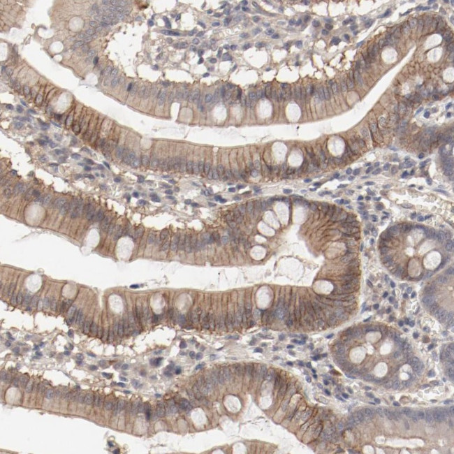 CD123 Antibody in Immunohistochemistry (Paraffin) (IHC (P))