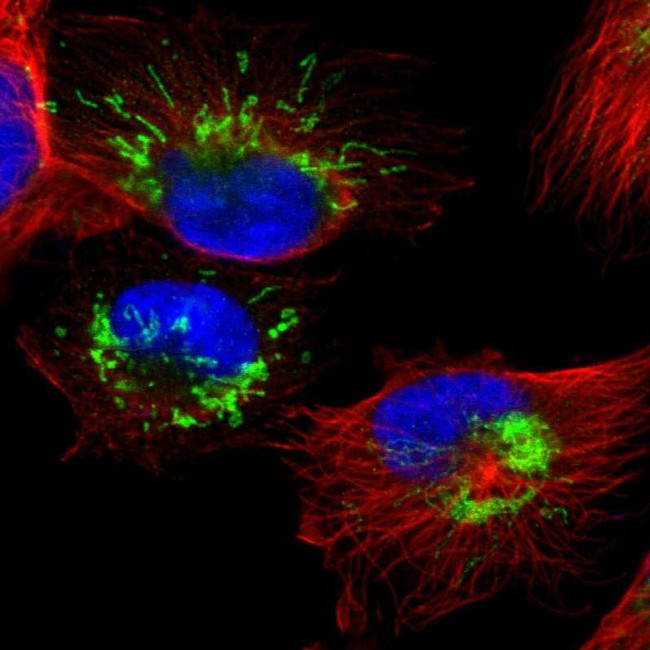 SETD3 Antibody in Immunocytochemistry (ICC/IF)