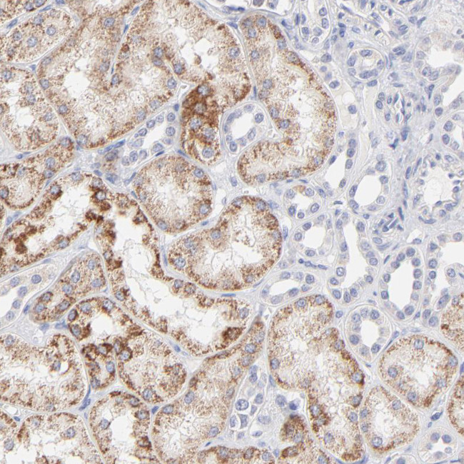 TST Antibody in Immunohistochemistry (Paraffin) (IHC (P))