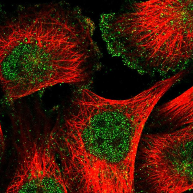 CD90 Antibody in Immunocytochemistry (ICC/IF)