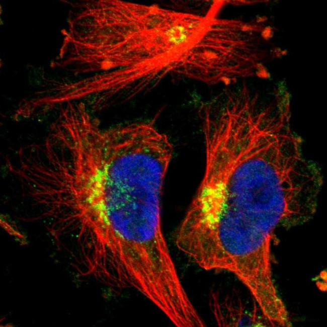 EPS8 Antibody in Immunocytochemistry (ICC/IF)