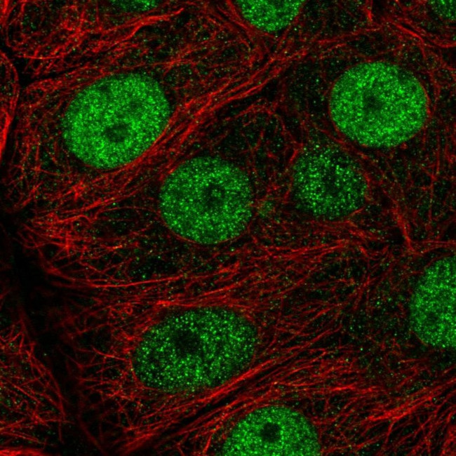 MCM7 Antibody in Immunocytochemistry (ICC/IF)