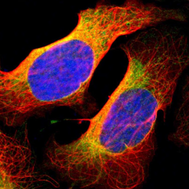 BAP31 Antibody in Immunocytochemistry (ICC/IF)