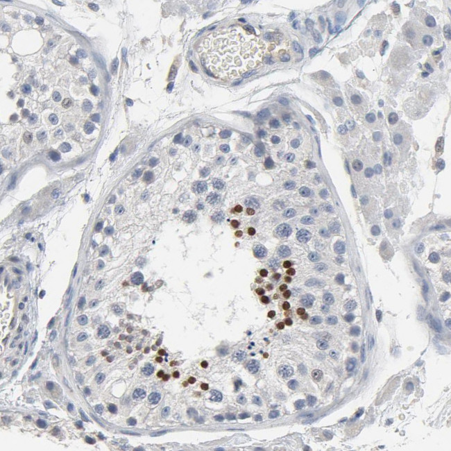 SOX6 Antibody in Immunohistochemistry (Paraffin) (IHC (P))