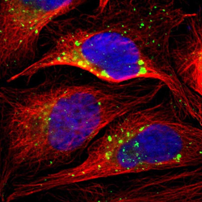 PSAP Antibody in Immunocytochemistry (ICC/IF)