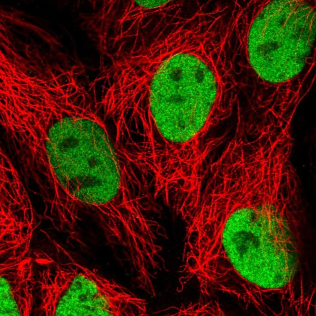 HNF4A Antibody in Immunocytochemistry (ICC/IF)