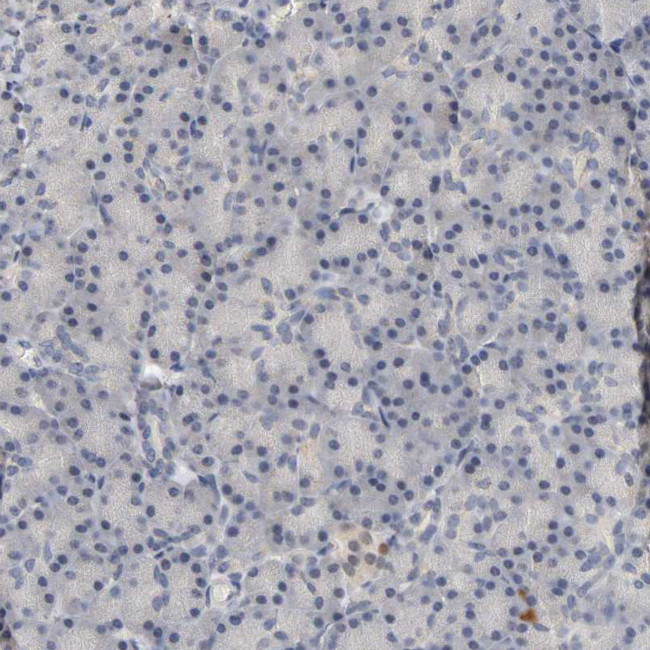 Progesterone Receptor Antibody in Immunohistochemistry (Paraffin) (IHC (P))