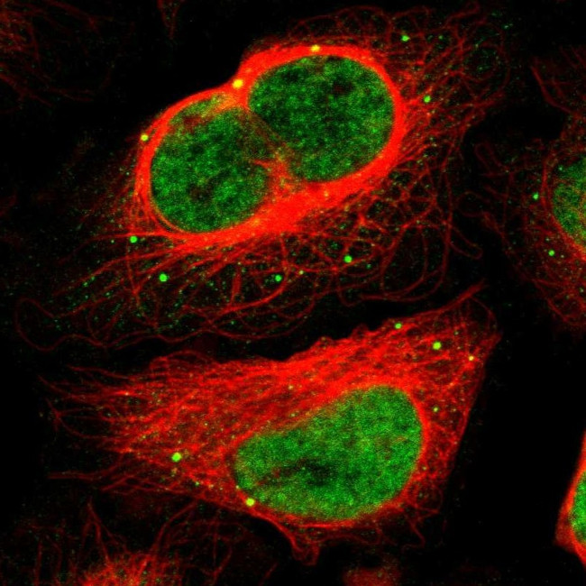 MEF2D Antibody in Immunocytochemistry (ICC/IF)