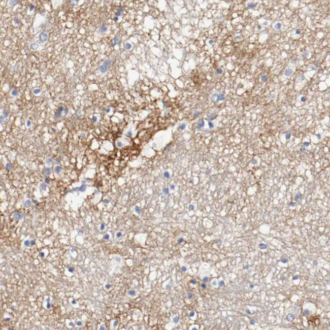 Tenascin C Antibody in Immunohistochemistry (Paraffin) (IHC (P))