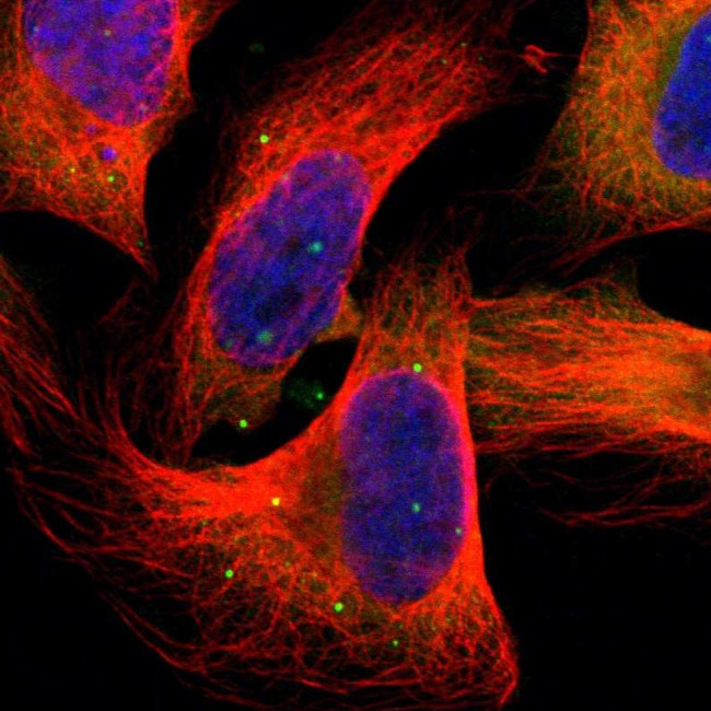 HGS Antibody in Immunocytochemistry (ICC/IF)