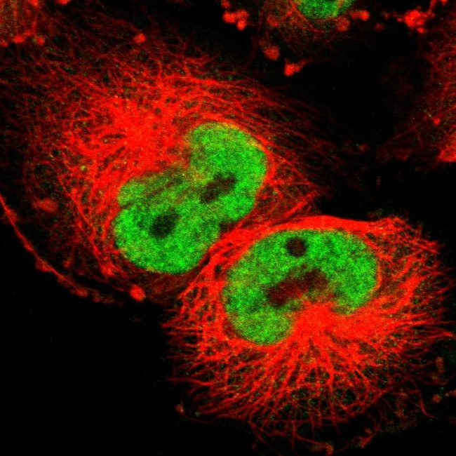 Cyclin T1 Antibody in Immunocytochemistry (ICC/IF)