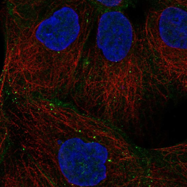 Desmoglein 2 Antibody in Immunocytochemistry (ICC/IF)