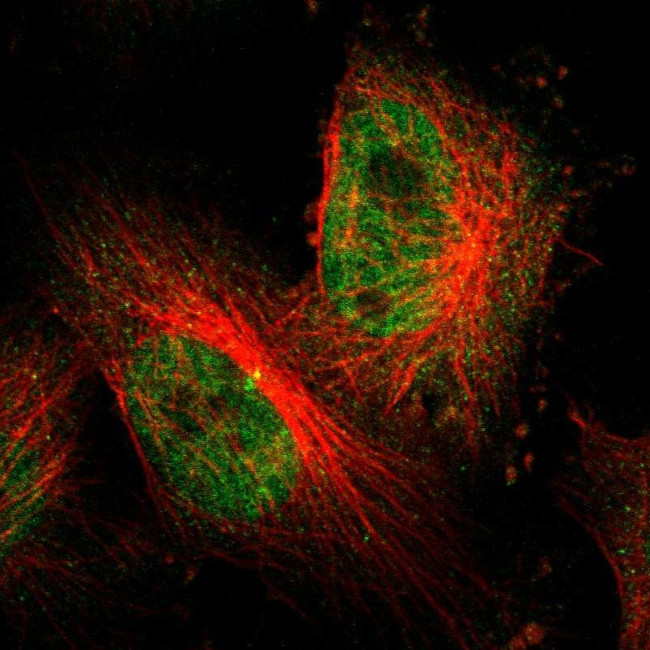 BCL6 Antibody in Immunocytochemistry (ICC/IF)