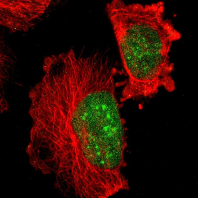 HP1 gamma Antibody in Immunocytochemistry (ICC/IF)