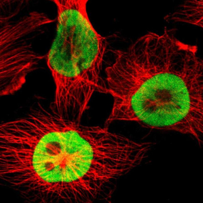 hnRNP D Antibody in Immunocytochemistry (ICC/IF)