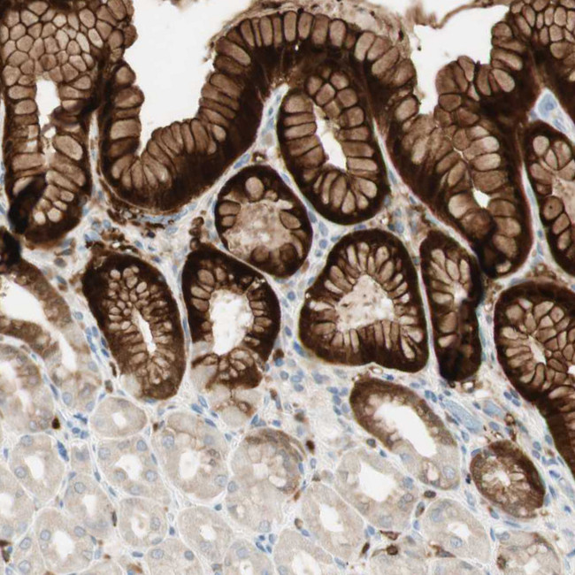 15-PGDH Antibody in Immunohistochemistry (Paraffin) (IHC (P))