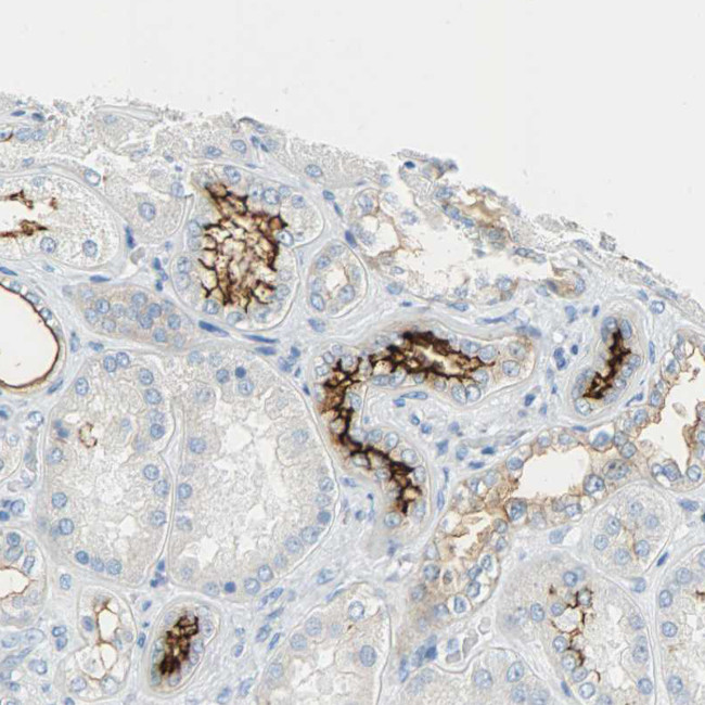 CD133 Antibody in Immunohistochemistry (Paraffin) (IHC (P))